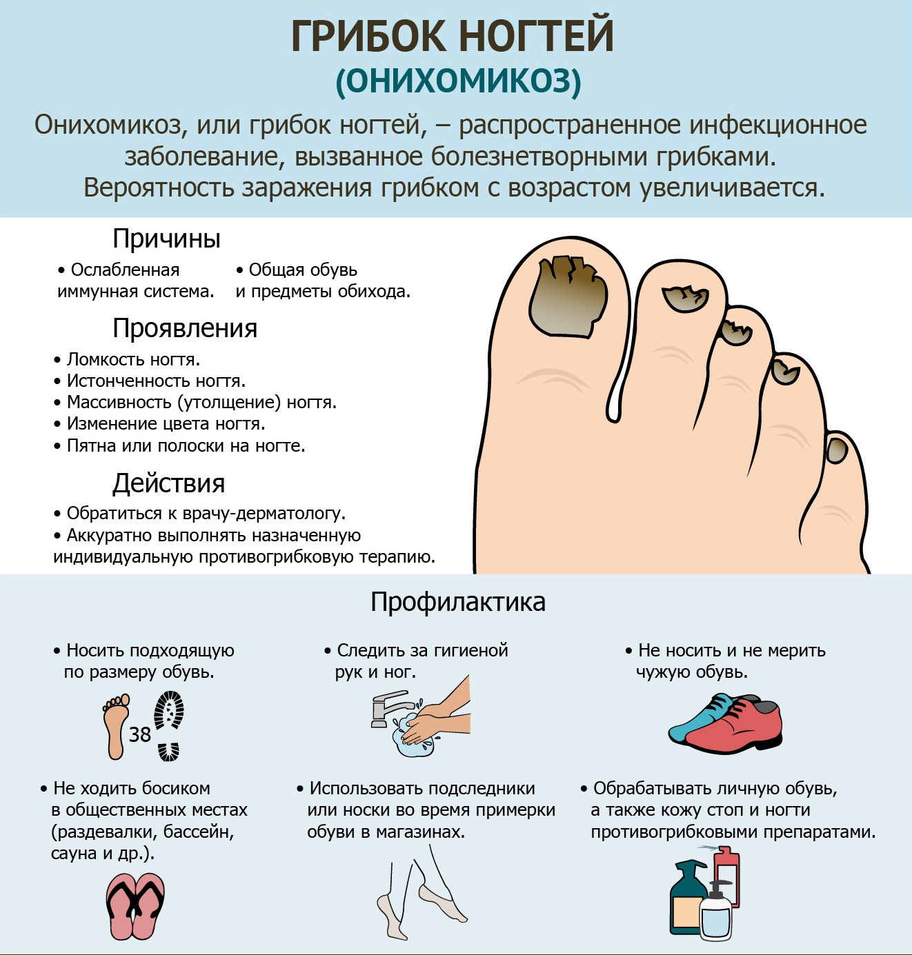 Грибок ногтей