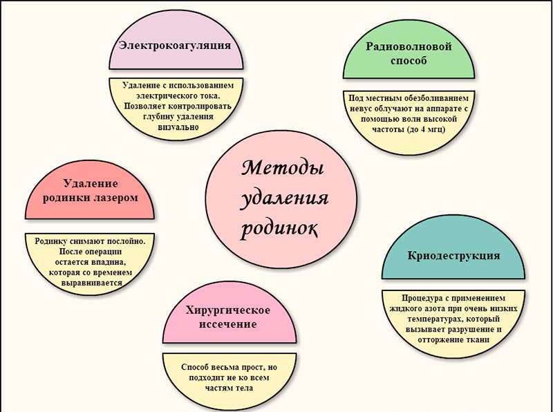 Методы удаления родинок