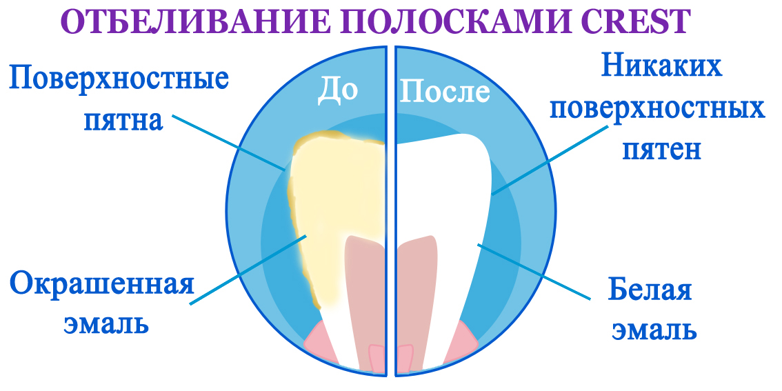 Отбеливание зубов полосками